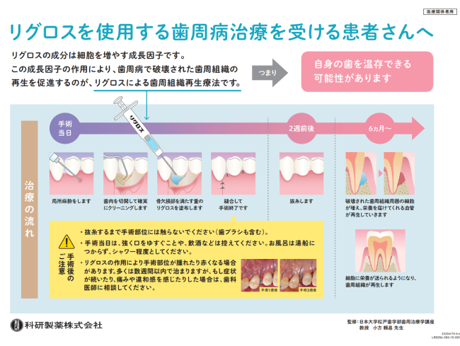 歯周組織再生療法